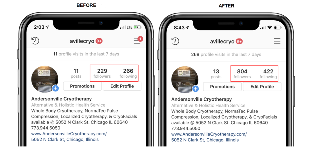 Instagram Tips for Cryotherapy Business Owners